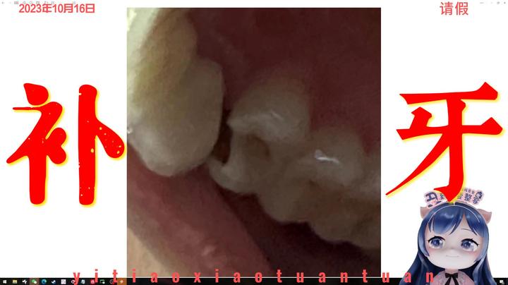 今日不播，请假补牙