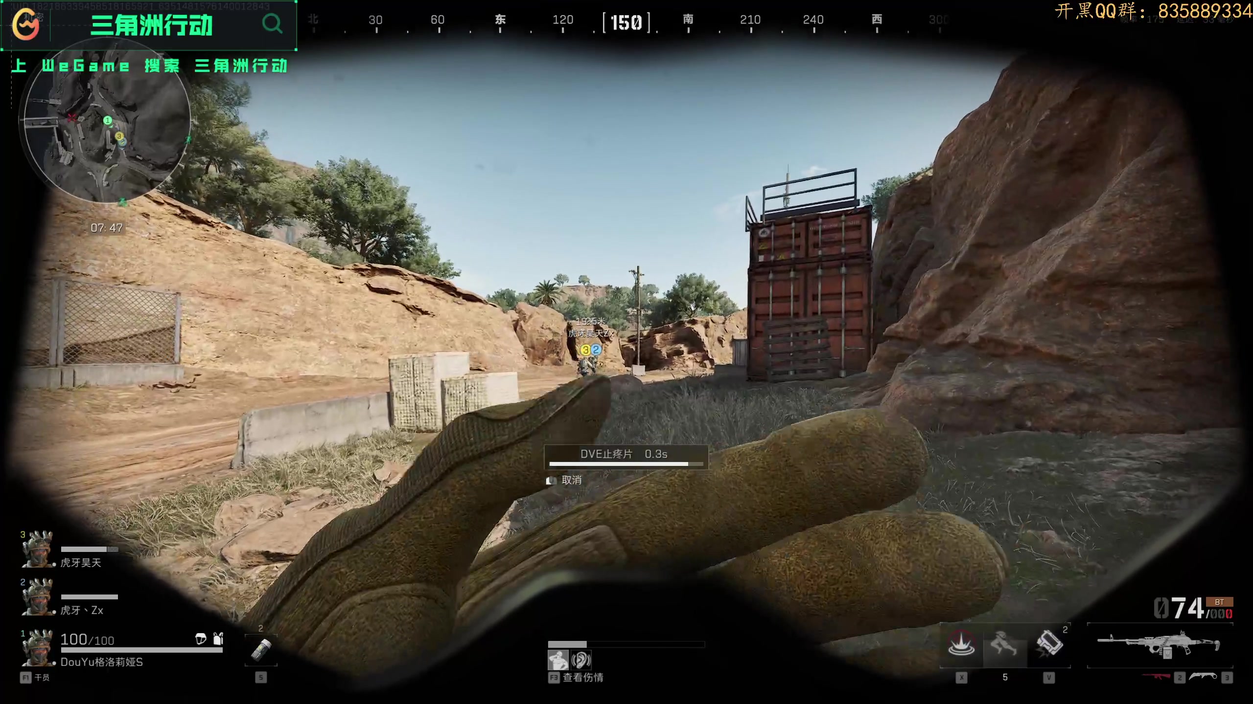 【2024-10-04 04点场】格洛莉娅S：十亿探长！